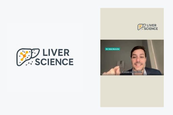 Tratamento sistêmico do carcinoma hepatocelular com anti-VEGF- Mitos ou Verdade